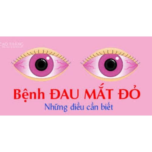 Những điều cần biết về Đau mắt đỏ